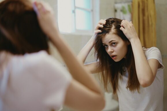 femeie cu alopecie