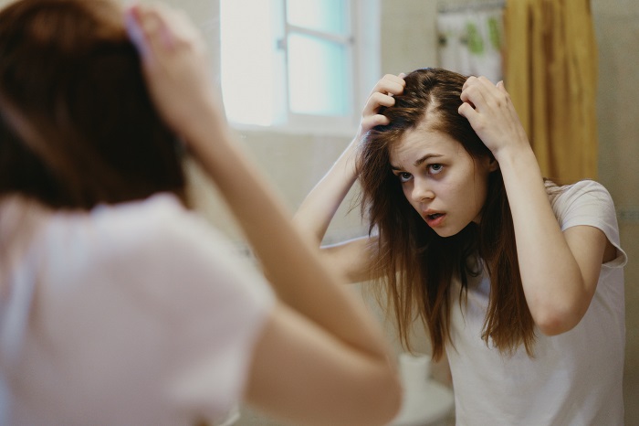 femeie cu alopecie