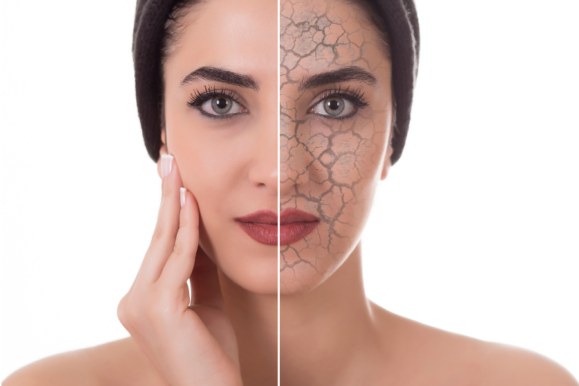 femeie cu piele uscata