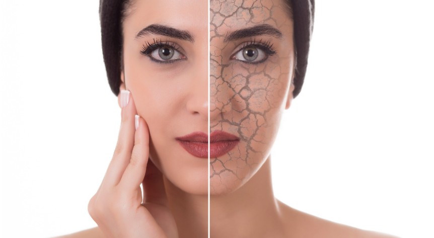 femeie cu piele uscata